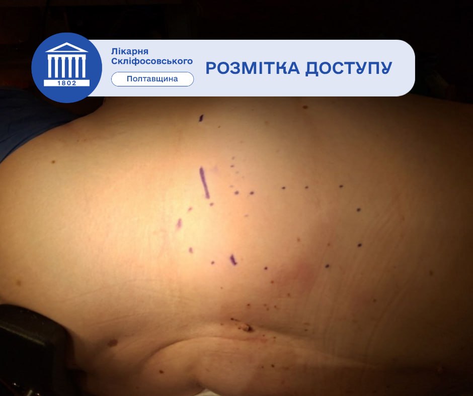 Розмітка доступу 